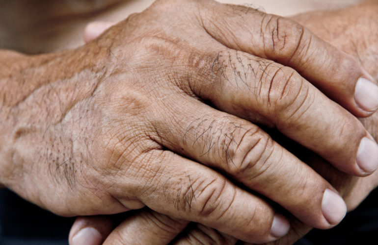 The Aging Homeless: Best Practices for End of Life Care